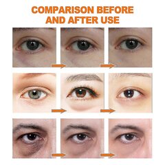 Jaysuing Vitamin C Tighten Firming Brightening Eye C-sriegis nuo tamsių ratų ir paburkimų stabdantis senėjimą | kaina ir informacija | Eteriniai, kosmetiniai aliejai, hidrolatai | pigu.lt