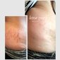 Rinkinys strijoms Ame Pure® Body Basic | Stretch Marks Kit kaina ir informacija | Anticeliulitinės, stangrinamosios priemonės | pigu.lt