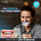 Dantų balinimo rinkinys „MySmile“ kaina ir informacija | Dantų šepetėliai, pastos | pigu.lt