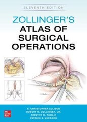 Zollinger's Atlas Of Surgical Operations, Eleventh Edition 11Th Edition kaina ir informacija | Užsienio kalbos mokomoji medžiaga | pigu.lt