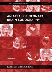 Atlas Of Neonatal Brain Sonography - Clinics In Developmental Medicine 2Nd Edition цена и информация | Пособия по изучению иностранных языков | pigu.lt