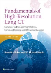 Fundamentals of High-Resolution Lung CT: Common Findings, Common Patterns, Common Diseases and Differential Diagnosis 2nd edition цена и информация | Книги по экономике | pigu.lt