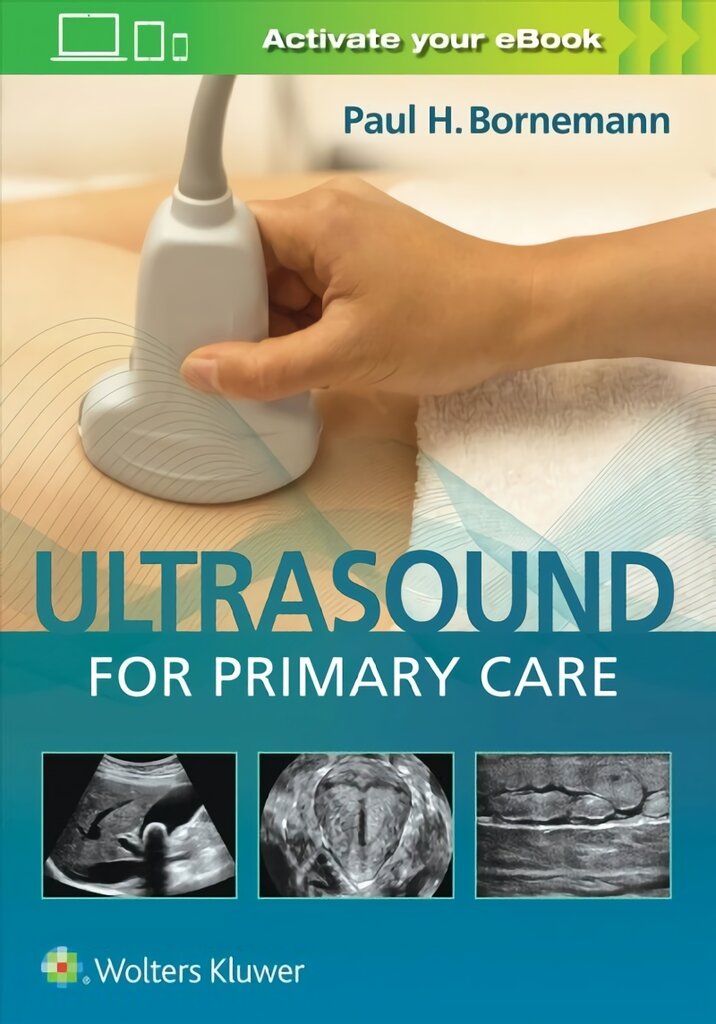 Ultrasound for Primary Care цена и информация | Ekonomikos knygos | pigu.lt