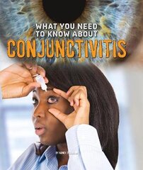 What You Need to Know about Conjunctivitis цена и информация | Книги для подростков  | pigu.lt