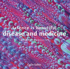 Science is Beautiful: Disease and Medicine: Under the Microscope kaina ir informacija | Saviugdos knygos | pigu.lt
