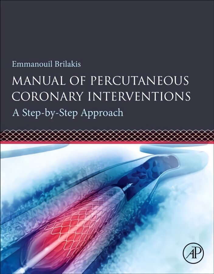 Manual of Percutaneous Coronary Interventions: A Step-by-Step Approach цена и информация | Ekonomikos knygos | pigu.lt