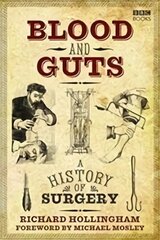 Blood and Guts: A History of Surgery kaina ir informacija | Ekonomikos knygos | pigu.lt