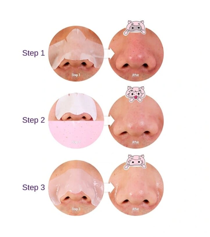 Inkštirus valantys odos pleistrai Holika Holika Pig Clear Blackhead 3-step kit, 8 g kaina ir informacija | Veido kaukės, paakių kaukės | pigu.lt