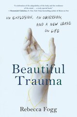 Beautiful Trauma: An Explosion, an Obsession, and a New Lease on Life kaina ir informacija | Socialinių mokslų knygos | pigu.lt
