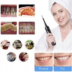 DentalForce DFCS2005 цена и информация | Электрические зубные щетки | pigu.lt