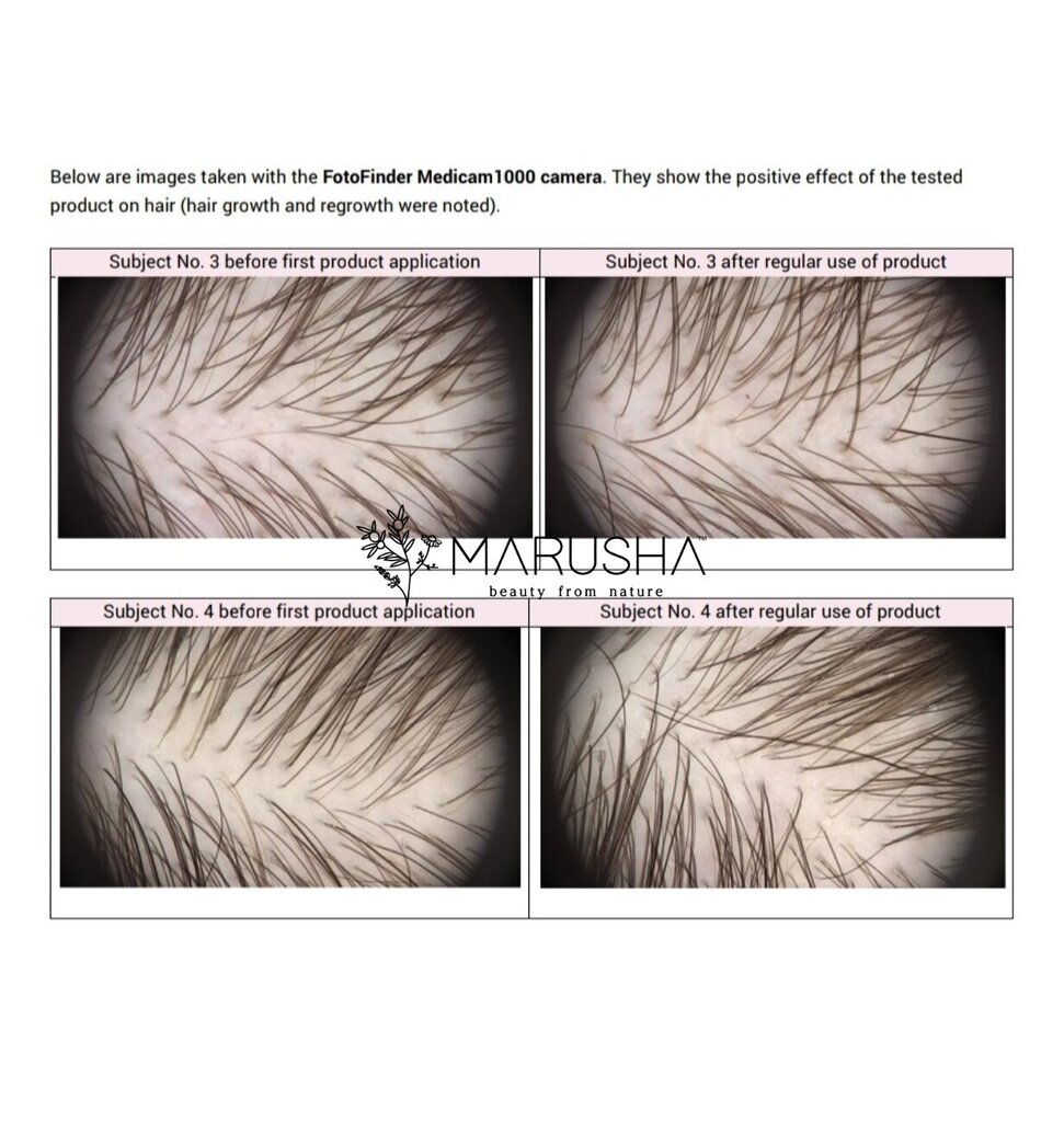 Rozmarinų aliejus plaukų augimui Marusha, 30 g kaina ir informacija | Priemonės plaukų stiprinimui | pigu.lt
