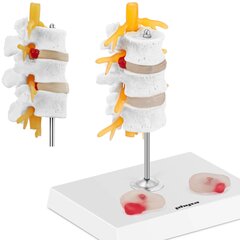 3D анатомическая модель поясничного отдела позвоночника с грыжами 3-5 позвонков цена и информация | Развивающие игрушки | pigu.lt