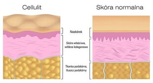 Celiulito ir strijų šalinimo rinkinys BingoSpa kaina ir informacija | Kūno kremai, losjonai | pigu.lt