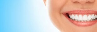 U-Smiler 359571 kaina ir informacija | Elektriniai dantų šepetėliai | pigu.lt