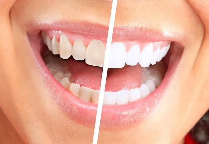 U-Smiler 359458 kaina ir informacija | Elektriniai dantų šepetėliai | pigu.lt