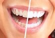 U-Smiler 991054 kaina ir informacija | Elektriniai dantų šepetėliai | pigu.lt