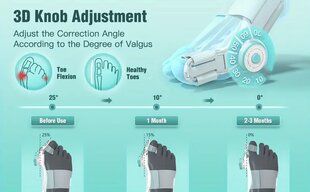 Регулируемый корректор суставов большого пальца ноги цена и информация | Ортезы и бандажи | pigu.lt